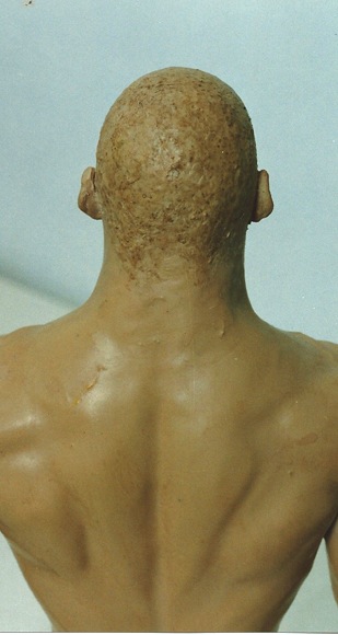 image1g